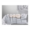 resina detax temp corone ponti dentali elevata resistenza a rottura lucidabile